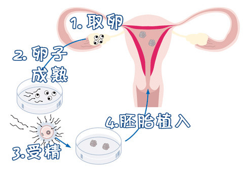 胚胎专家